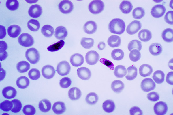 En el caso de los parásitos, como el Plasmodium falciparum, responsable de la malaria en los seres humanos, los investigadores estudian especialmente su metabolismo con el fin de determinar nuevos blancos para drogas antiparasitarias.