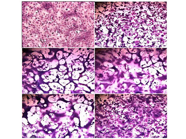 Imágenes microscópicas en las que se observan diferentes efectos del virus herpes simple sobre distintas variantes de células.